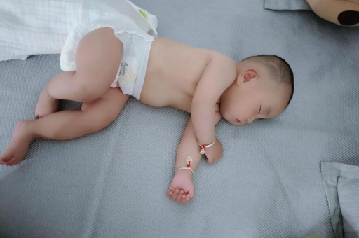 常州宝宝脸上有白色斑块
